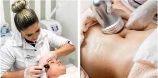 Lipocavitação: especialista explica procedimento que elimina gordura localizada sem cirurgia