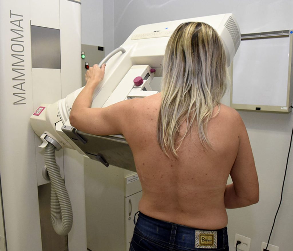 Mamografia em Jundiaí