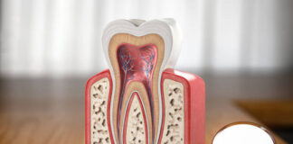 Tratamento de Canal em Itu – Soluções Avançadas em Endodontia