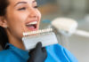 Facetas Estéticas em Avaré – Sorrisos Renovados com Naturalidade