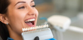 Facetas Estéticas em Avaré – Sorrisos Renovados com Naturalidade