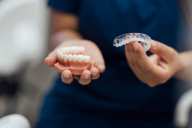 Alinhadores Dentários Transparentes em Avaré: Conquiste seu novo sorriso